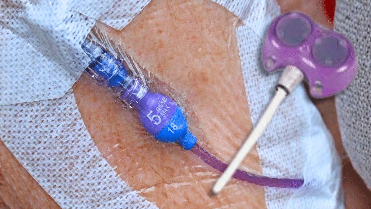 Bard PowerPort Catheter Complications